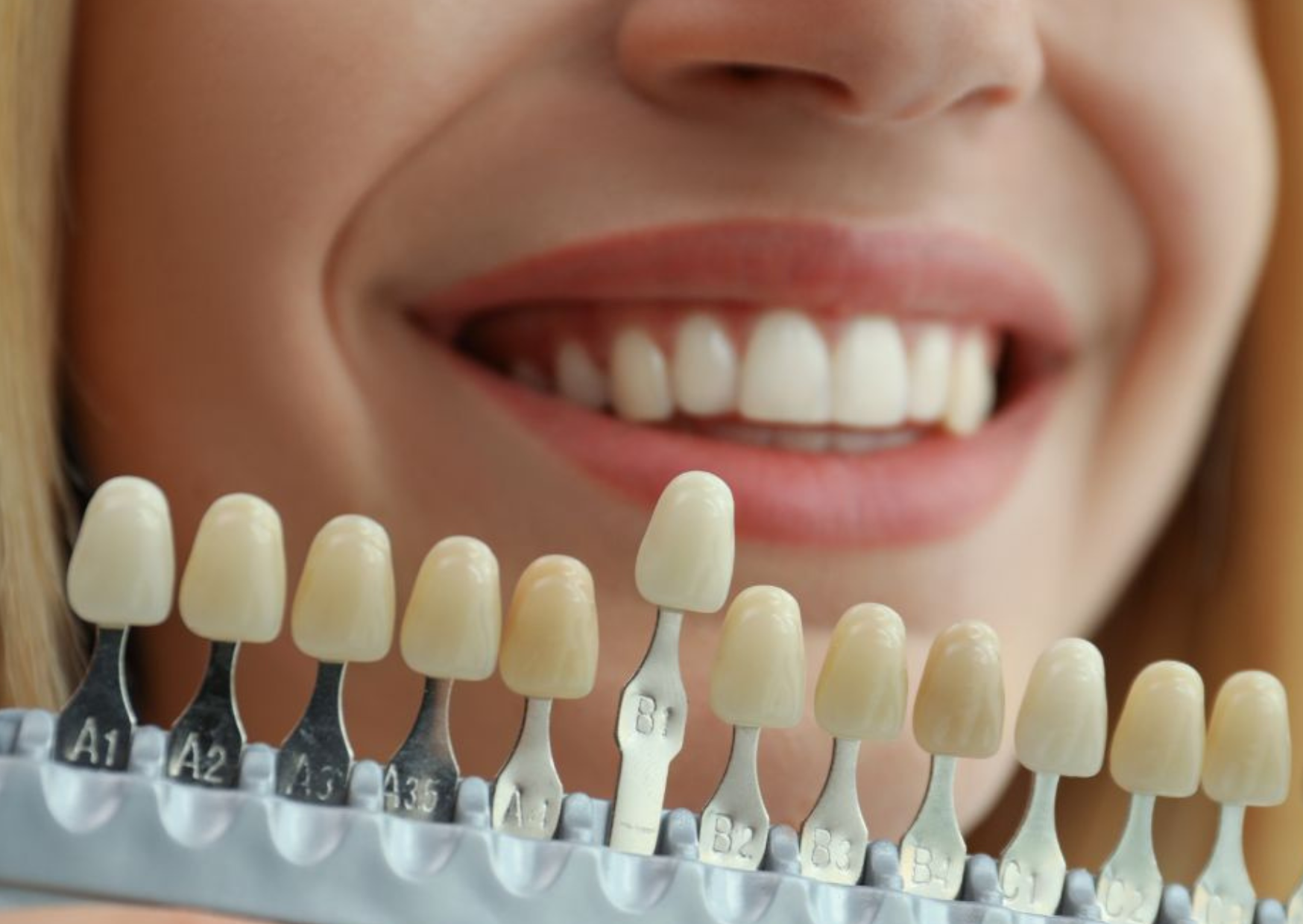 Cosmetic Dentistry